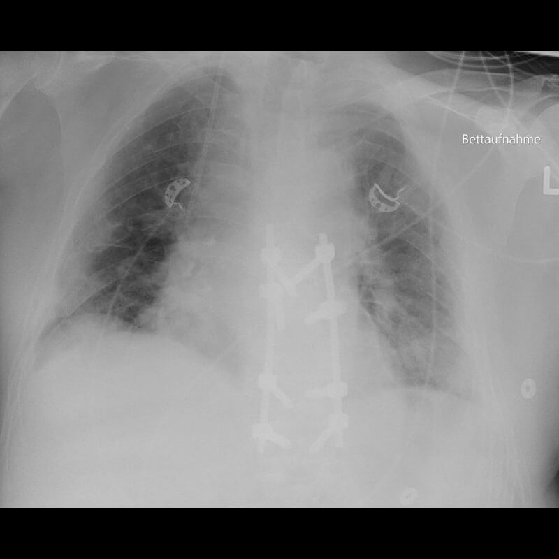 Clinical Image Gallery - Canon Medical Components Europe