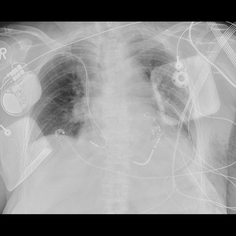 Clinical Image Gallery - Canon Medical Components Europe