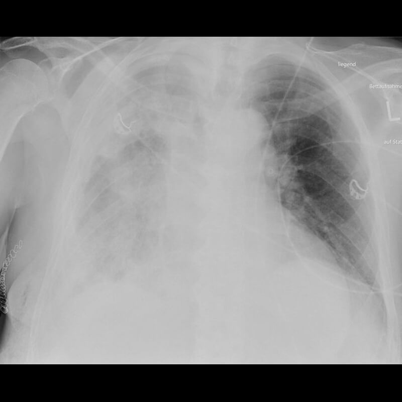 Clinical Image Gallery - Canon Medical Components Europe